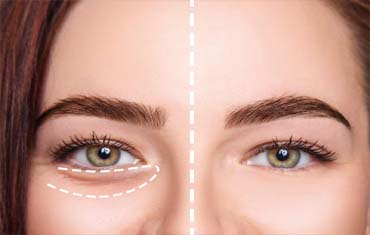 Ayurveda Surgical Treatments in Gandhinagar
