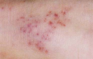 Ayurveda Surgical Treatments in Gandhinagar
