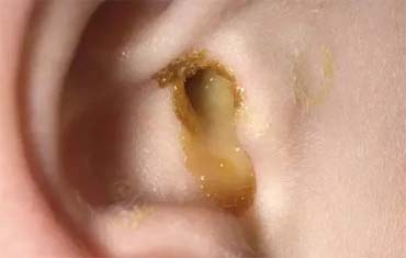 Orodental Care Treatment in Gandhinagar
