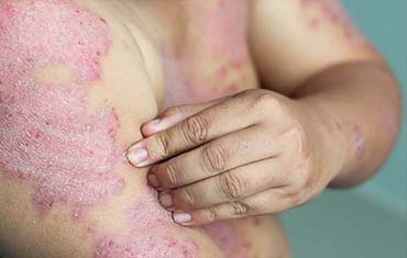 Haematology Test in Gandhinagar
