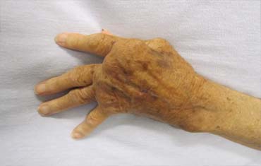 Orodental Care Treatment in Gandhinagar
