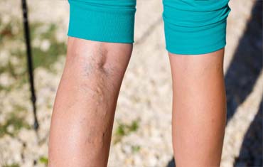 Ayurveda Surgical Treatments in Gandhinagar
